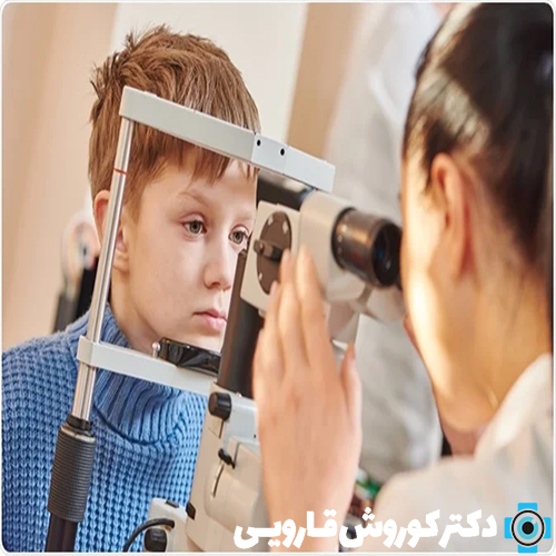 فوق تخصص چشم در مازندران
