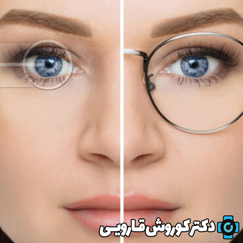 سن مناسب برای عمل لیزیک چشم