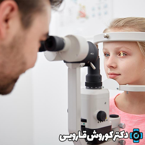 فوق تخصص چشم پزشکی