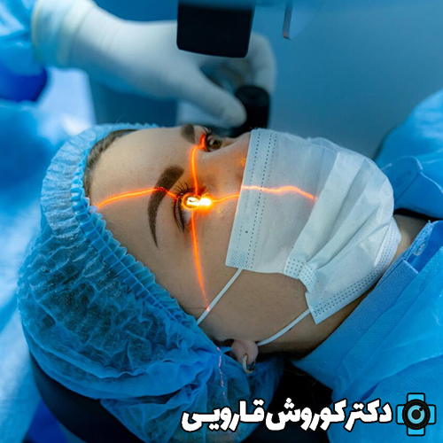 0 تا 100 عمل جراحی لیزیک چشم در مازندران