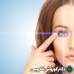 قطره‌های چشمی بعد از عمل لیزیک و لازک