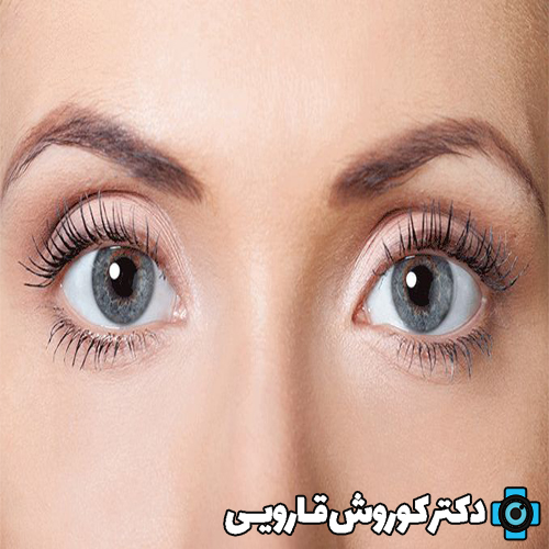 اثرات روزه داری بر روی چشم