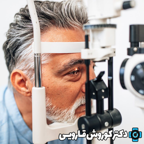 روش‌های درمان آستیگماتیسم