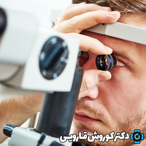 روش‌های درمان آستیگماتیسم