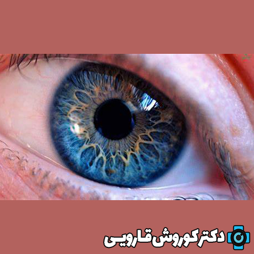 تأثیر نور UV بر سلامت چشم: پیشگیری و محافظت