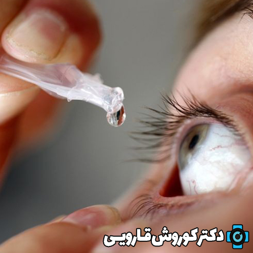 بیماری‌های قرنیه: علل، تشخیص و درمان