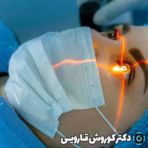 راهکارهای کاهش درد بعد از عمل PRK، لازک و لیزیک