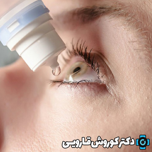 راهکار های کاهش درد چشم بعد از عمل PRK،لازک و لیزیک