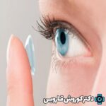 حفاظت شده: علل ایجاد زخم راجعه قرنیه،علائم ودرمان آن