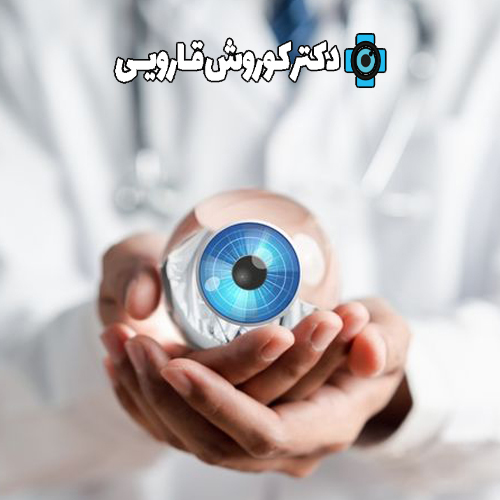 حفاظت شده: عنوان مقاله: علل مگس پران چشم چیست؟