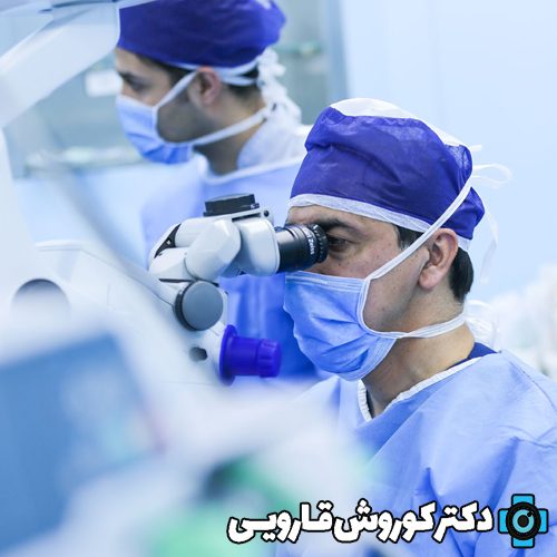 بهترین جراح آب مروارید در مازندران