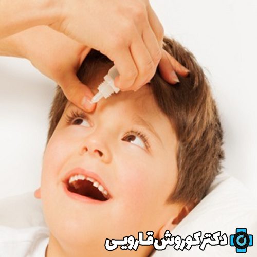 روش استفاده صحیح از قطره چشمی