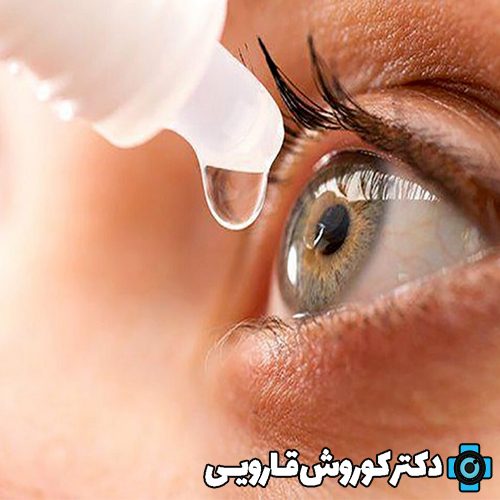 روش استفاده صحیح از قطره چشمی