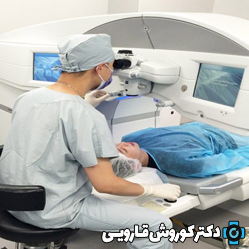 بهترین جراح لازک چشم در مازندران