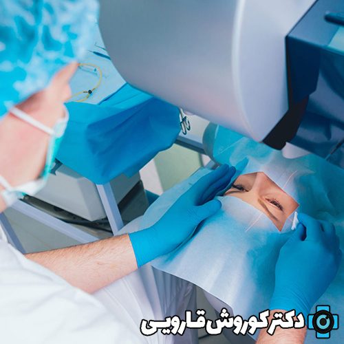 بهترین جراح لازک چشم در مازندران