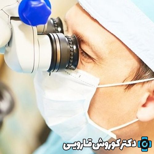 بهترین جراح لیزیک چشم در مازندران