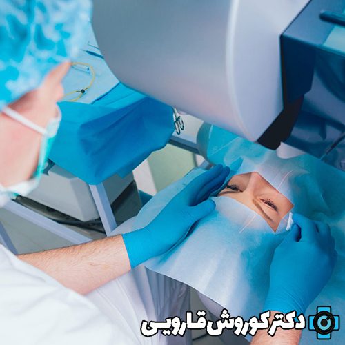 عمل جراحی لیزیک چشم